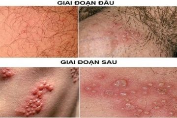 DƯƠNG VẬT BỊ NGỨA CẢNH BÁO ĐIỀU GÌ, NGUYÊN NHÂN VÀ CÁCH HỖ TRỢ ĐIỀU TRỊ